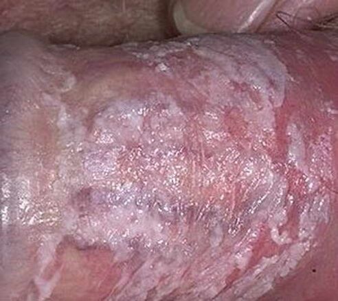secrete fluid that coagulates when stimulated