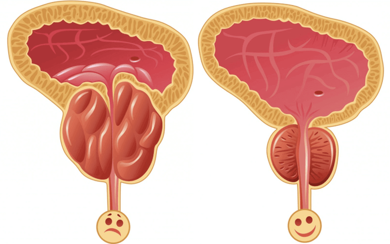 Causes of physiological problems in men